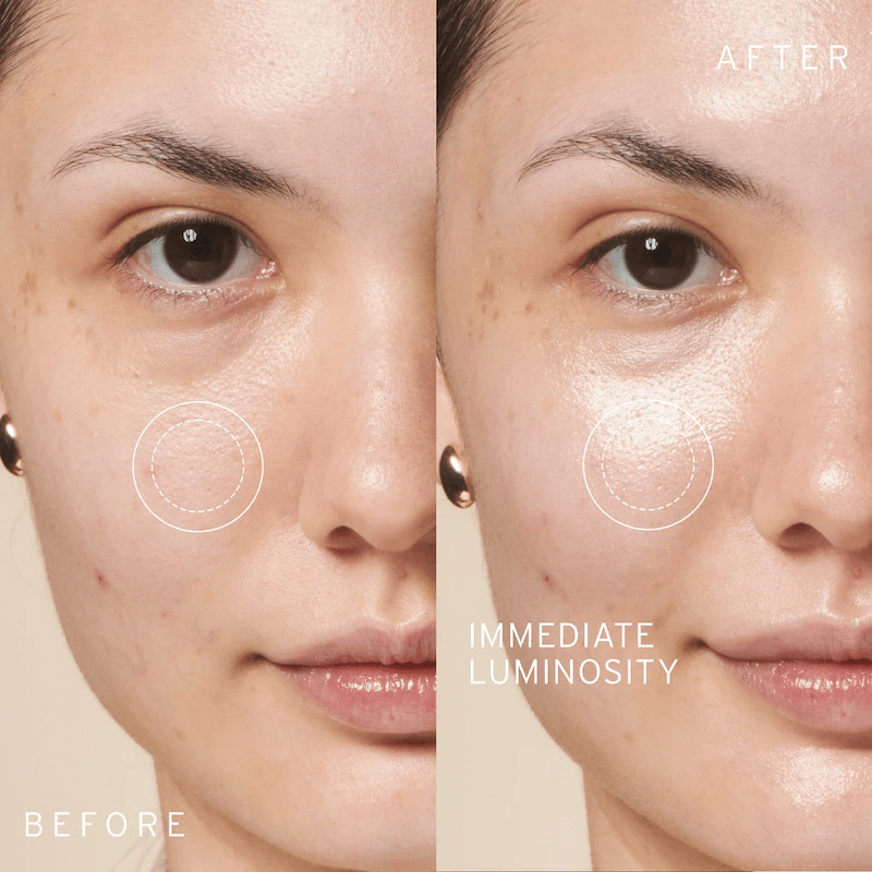 kombucha benefit in skin care